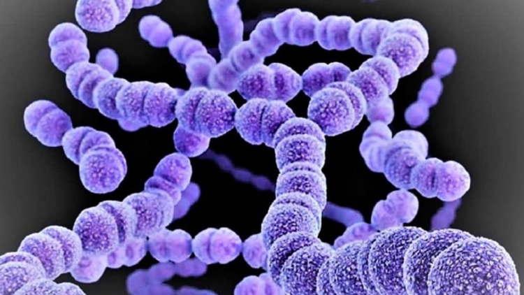 0_angina-bacteriana.jpg