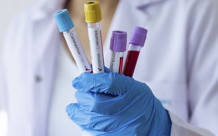 0_coronavirus-54.jpg