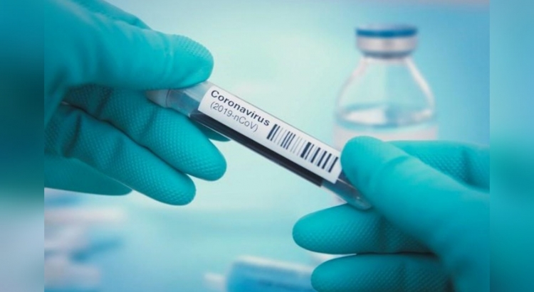 0_coronavirus-70.jpg